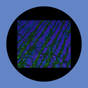 P5853 Abstracts 5853 - Rosco Plastic Gobo